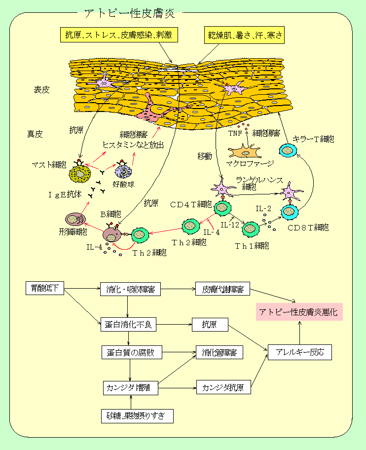 アトピー性皮膚炎と免疫応答の図表